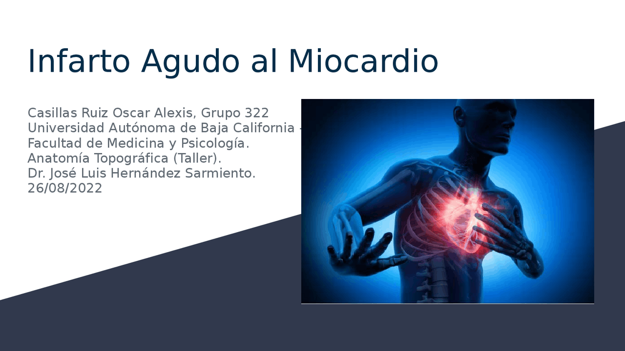 Infarto Agudo al Miocardio | Diapositivas de Anatomía | Docsity
