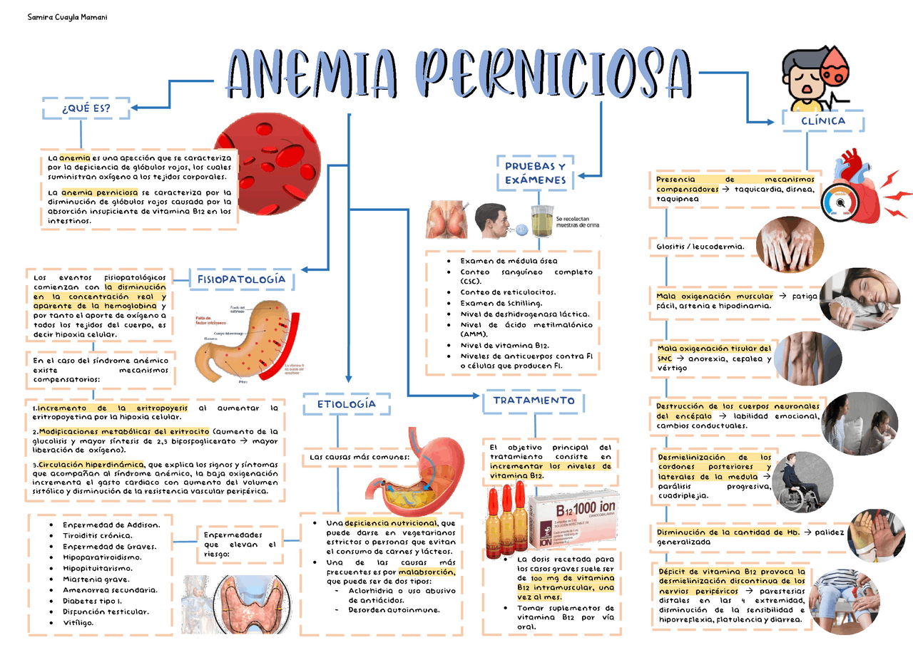ANEMIA PERNICIOSA dcl | Resúmenes de Organización y Gestión del ...