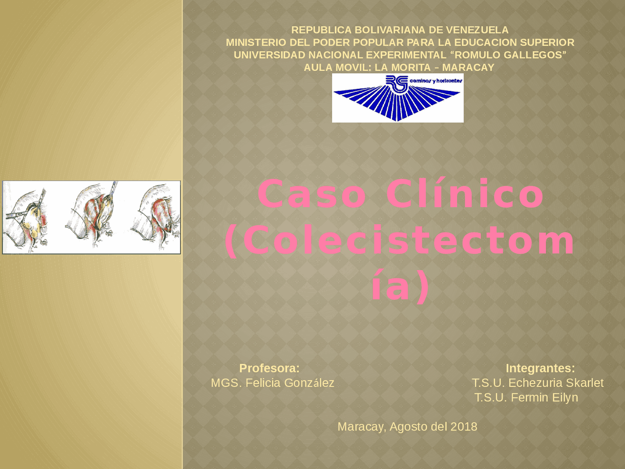 Cuidados de Enfermería en Paciente Postoperatorio de Colecistectomía