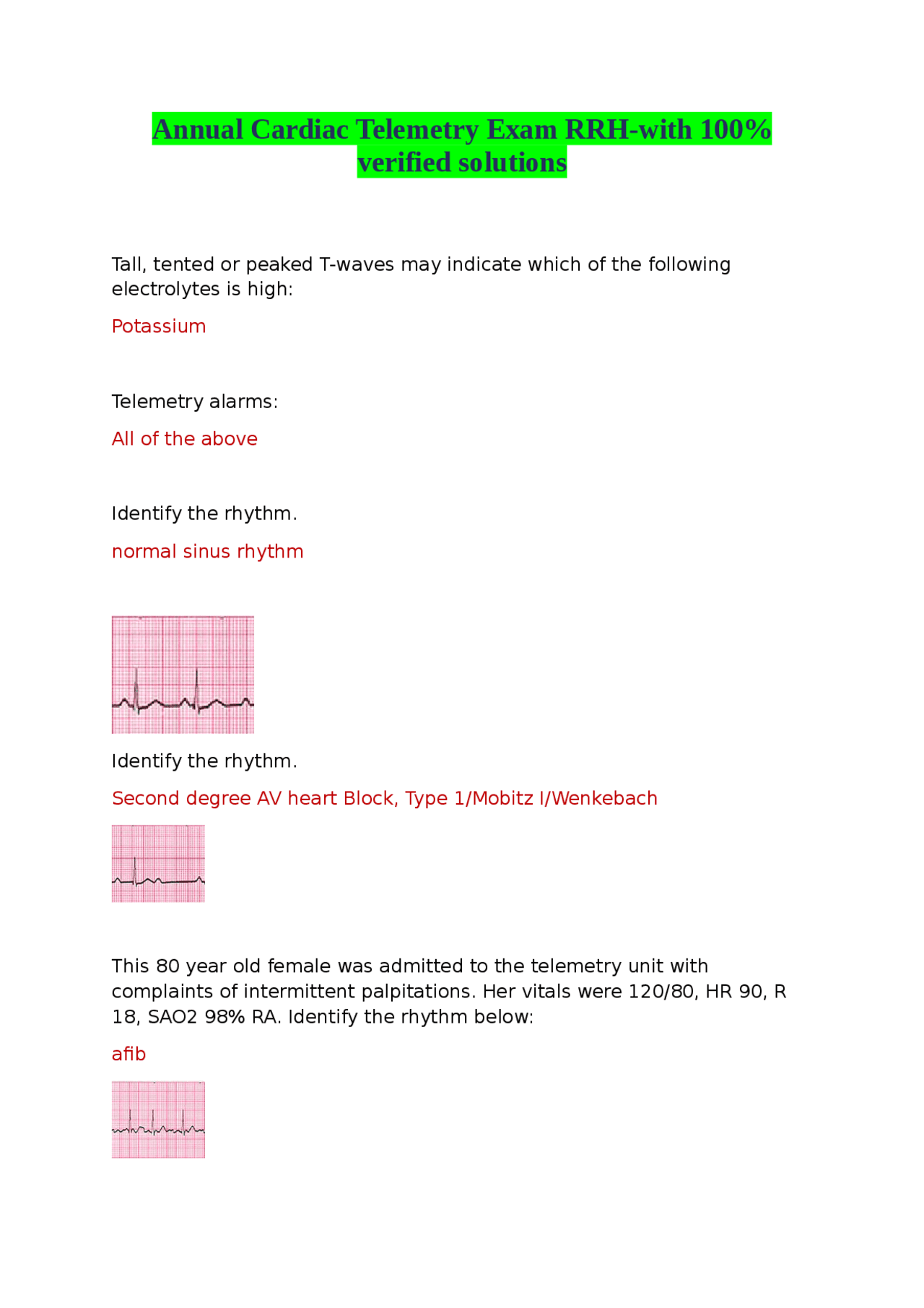 Cardiac Telemetry Exam Solutions for RRH | Exams Nursing | Docsity