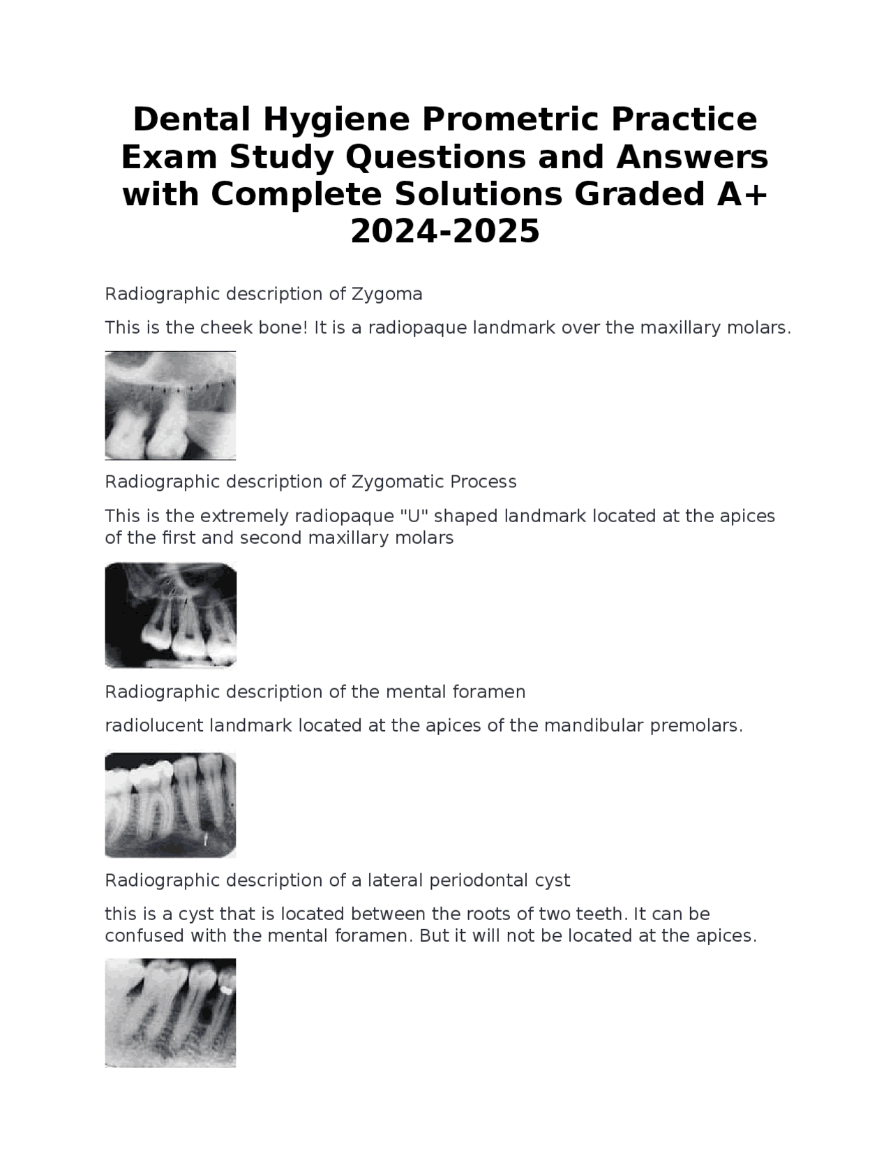 Dental Hygiene Prometric Practice Exam Study Questions and Answers with