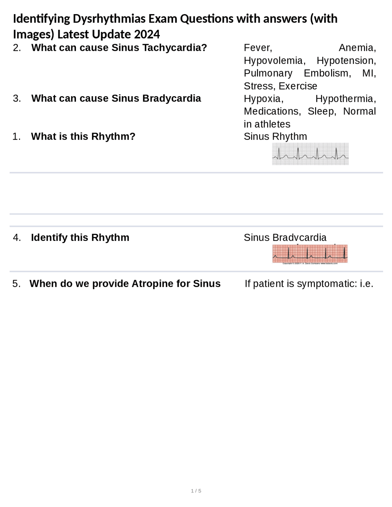 Identifying Dysrhythmias Exam Questions with answers (with Images ...