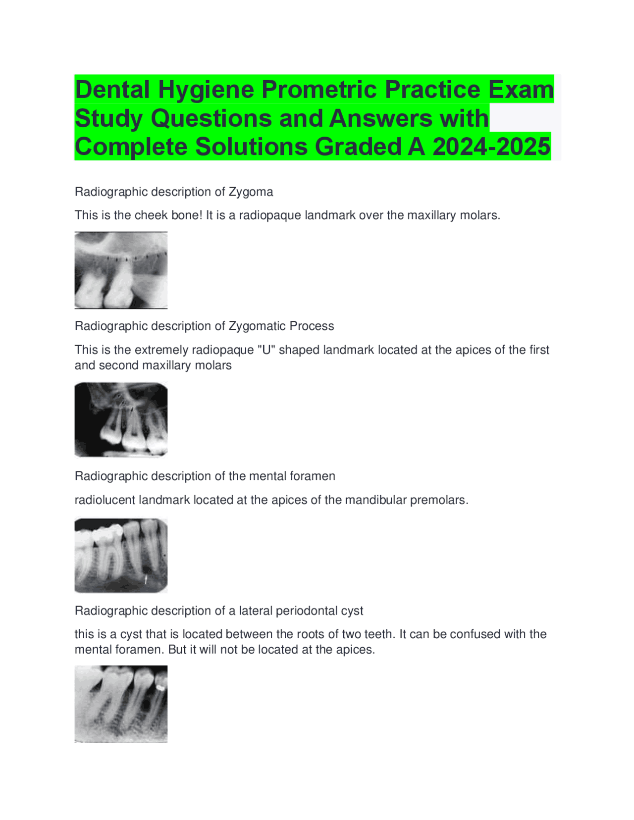 Prometric Note Dental Hygiene Prometric Practice Exam Study Questions and Answers with ...