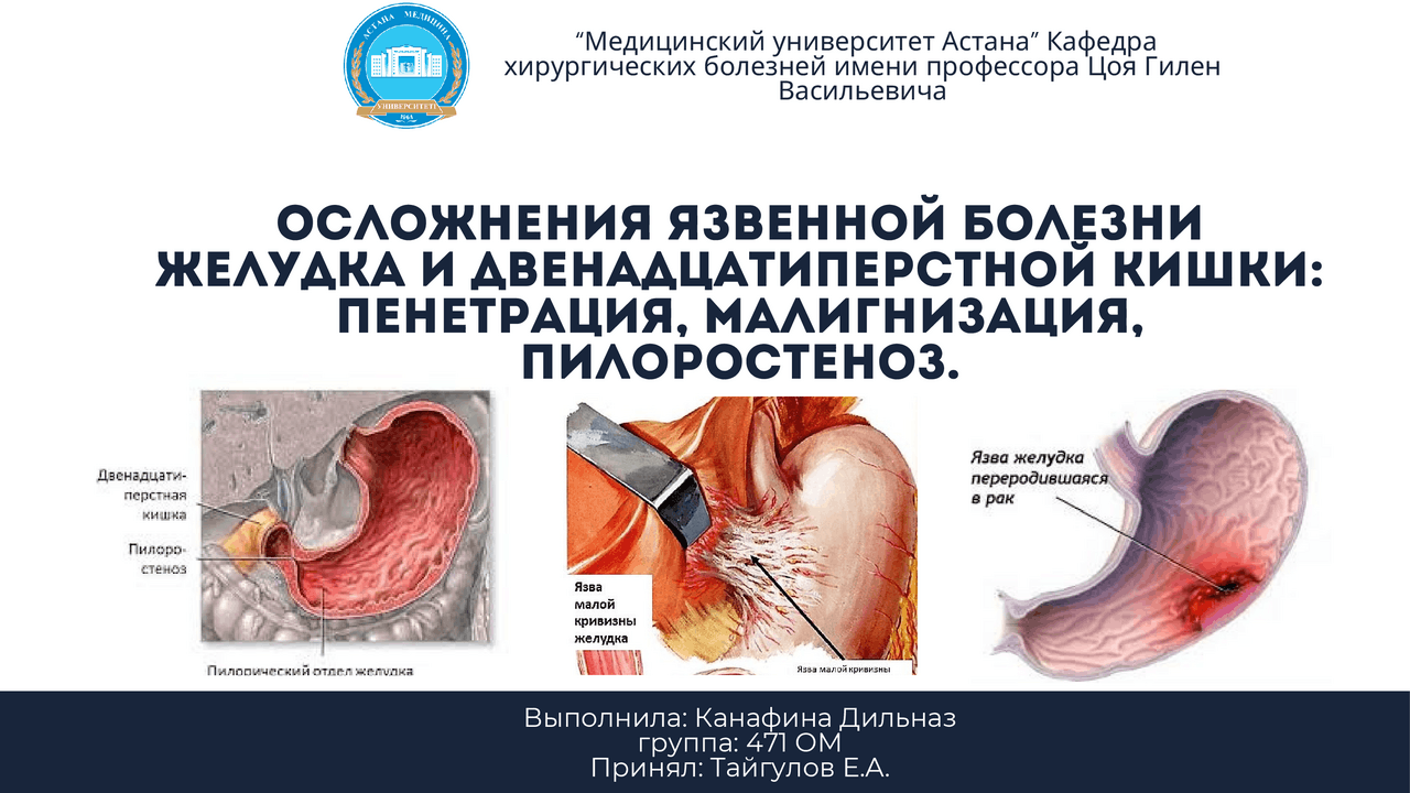 Мишель Уайлд порно фильм