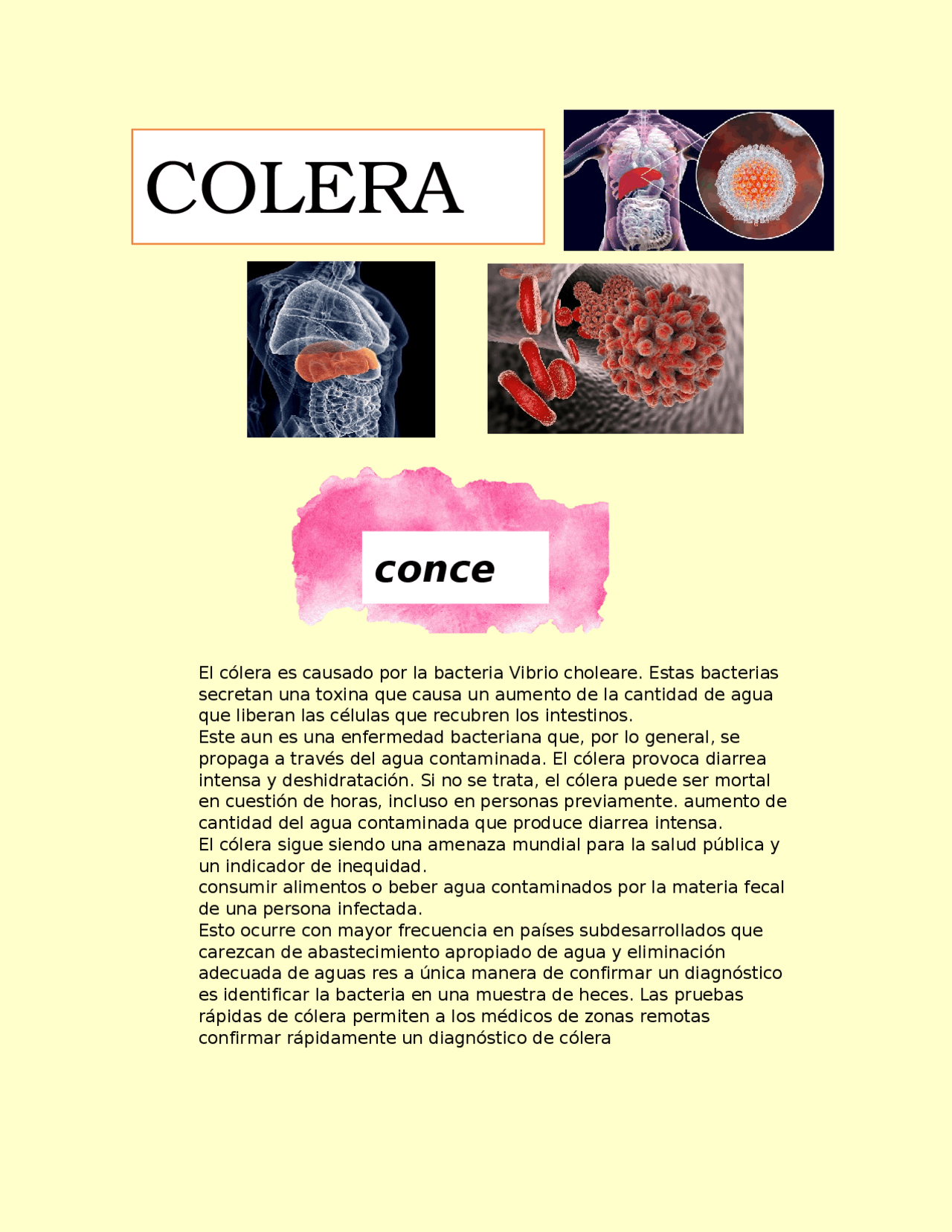 Cólera Síntomas Y Tratamiento , Cómo actuar ante un ataque de cólera ...