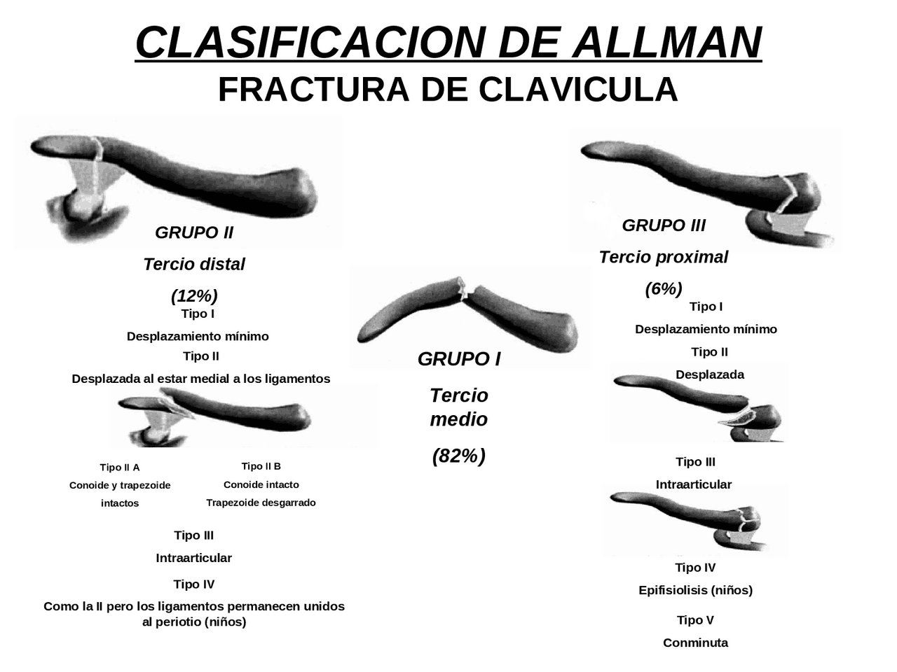 Descarga Resúmenes - FRACTUVRAS DE CLAVICULA | Universidad de Buenos Aires ...
