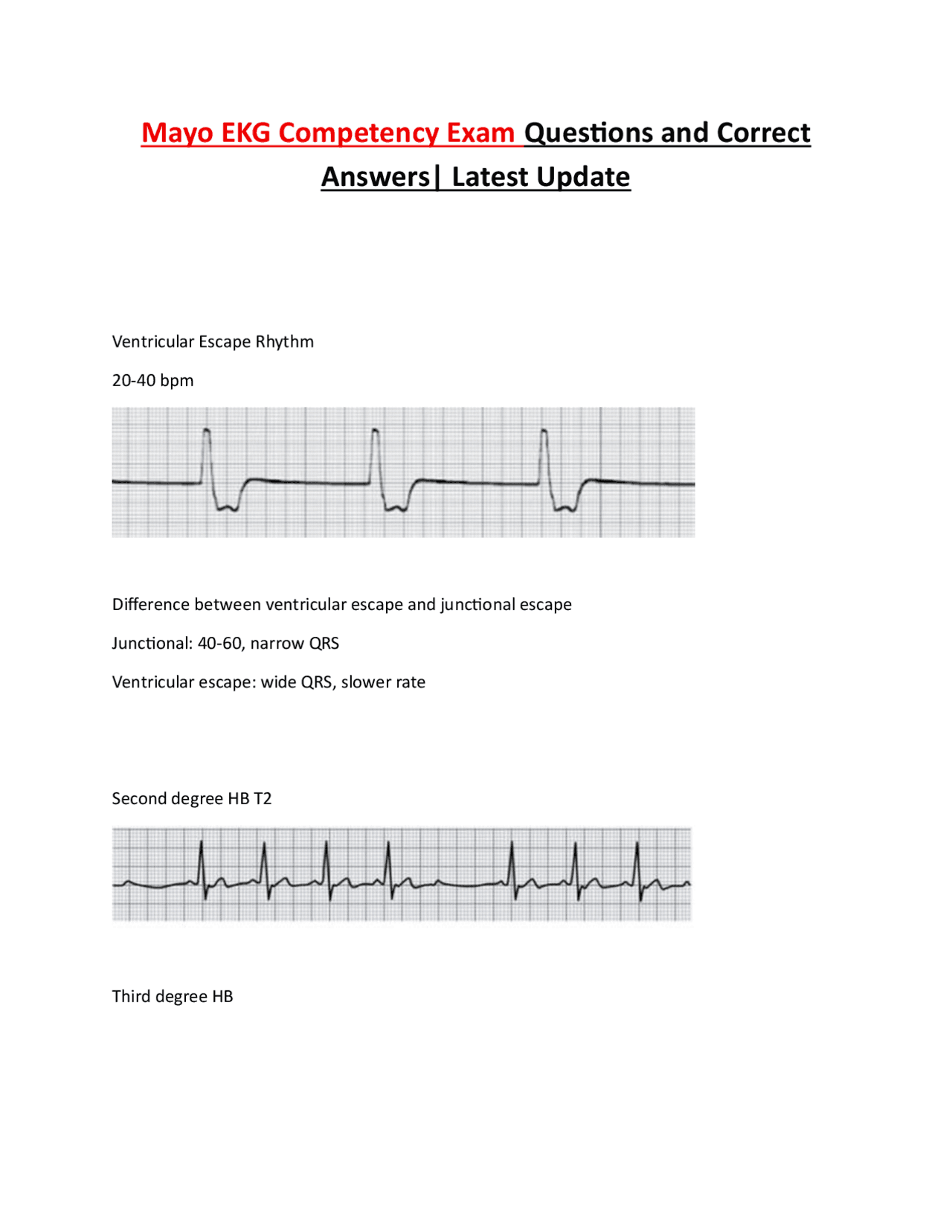 EKG Competency Exam: Questions and Answers for Medical Professionals ...