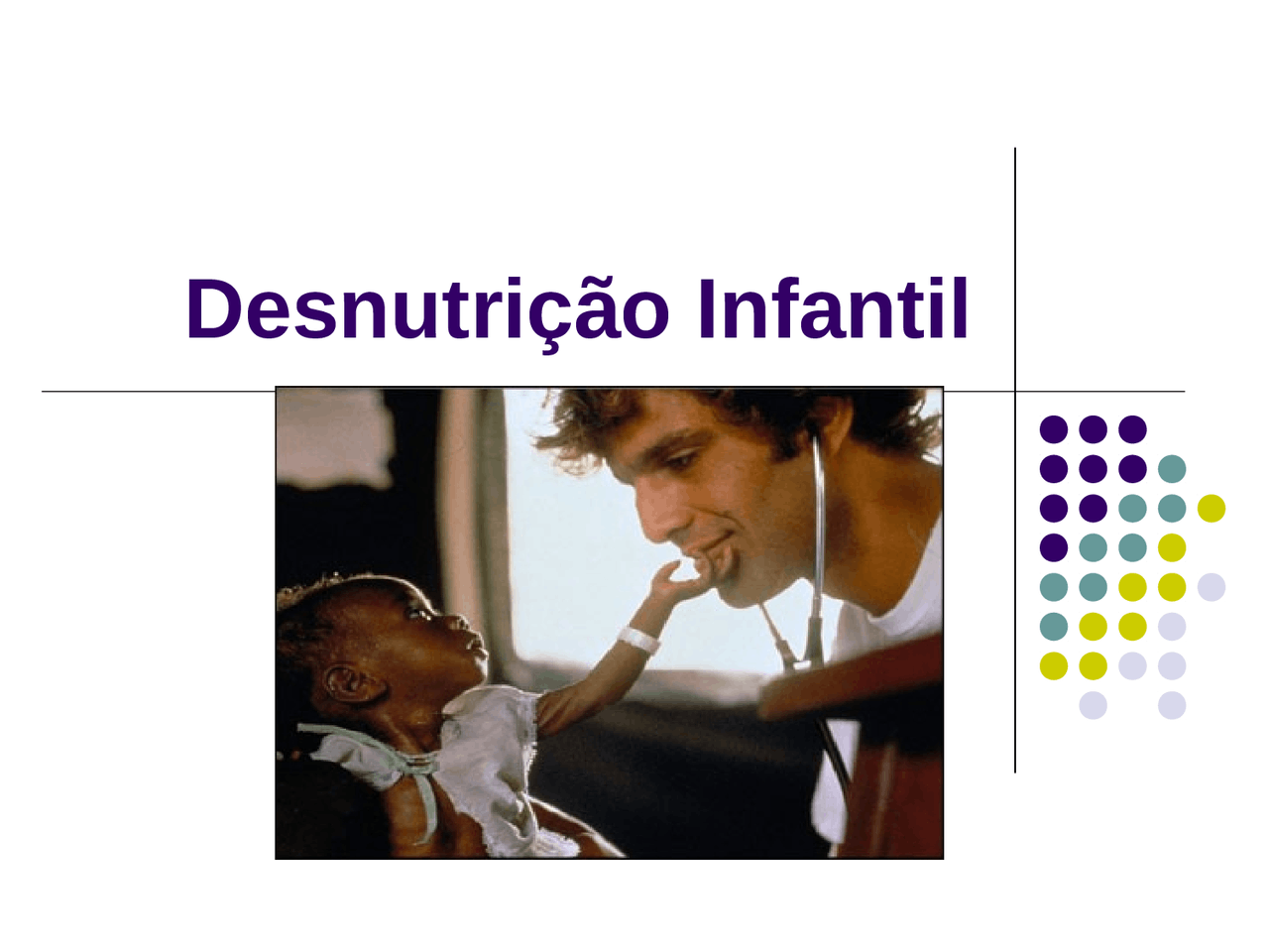 Desnutrição infantil - Material AIDIPI | Docsity