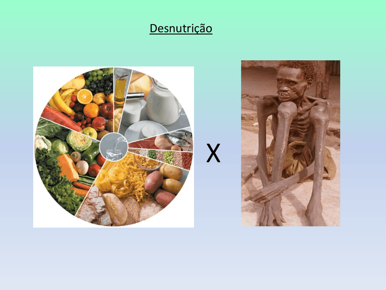 Desnutrição - Matéria de Nutrição Clínica - Docsity