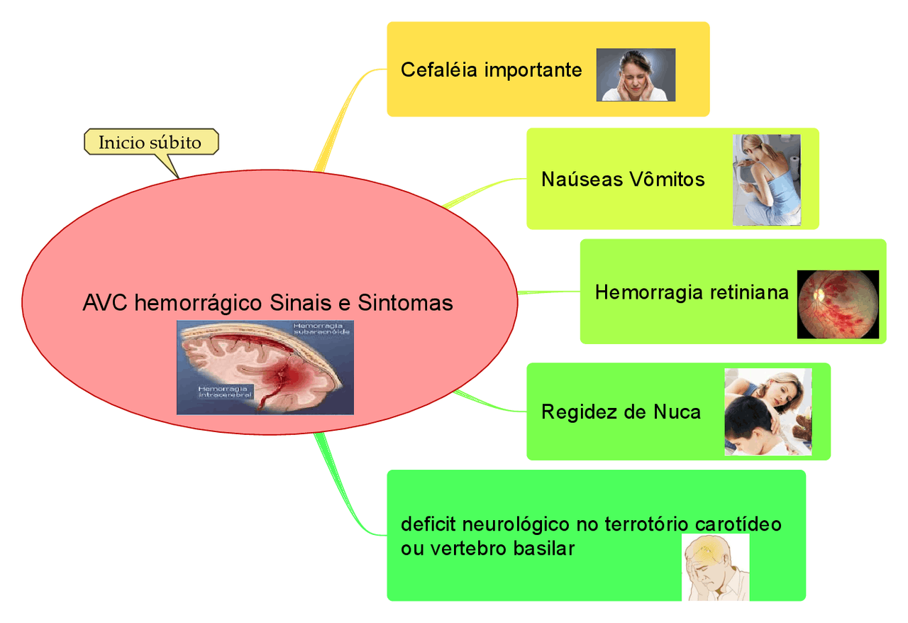 Mapa mental , Avc hemorrágico - mapa mental com sinais e sintomas AVC ...