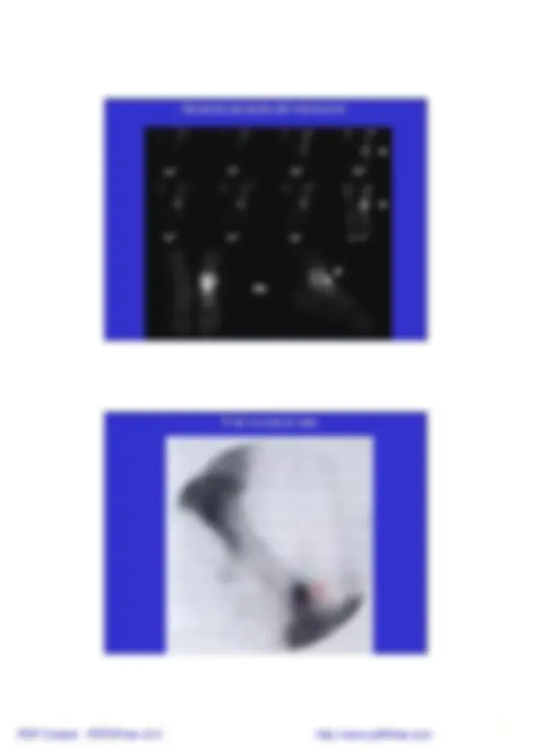 pf13