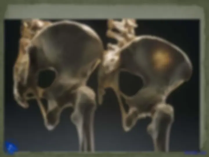 pfa