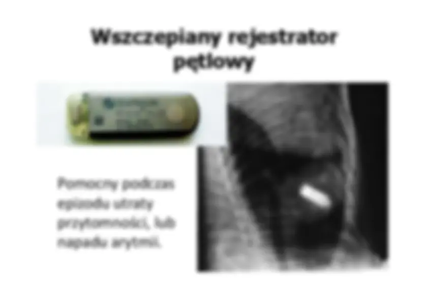 pfa