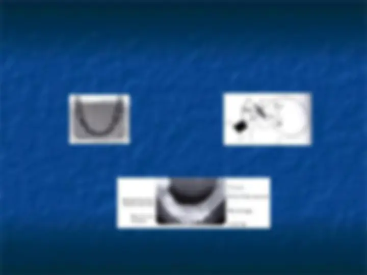 pfe