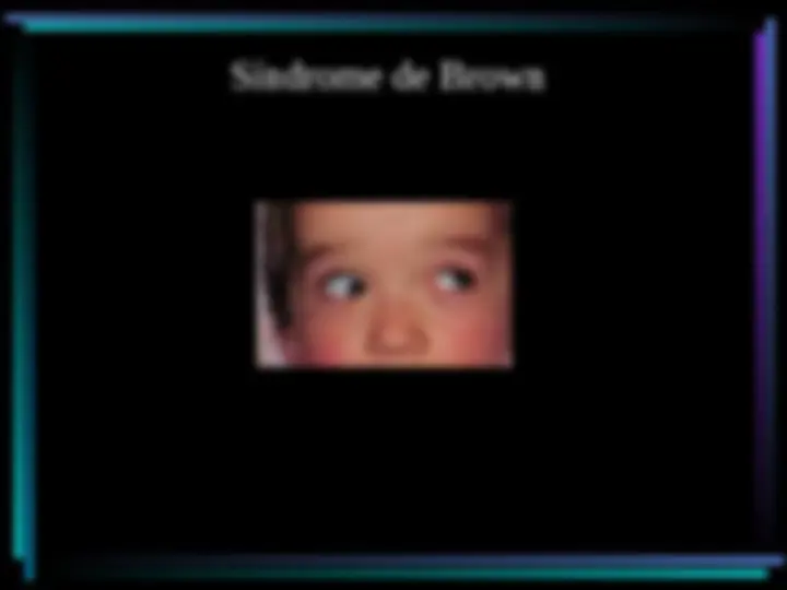 pf4e