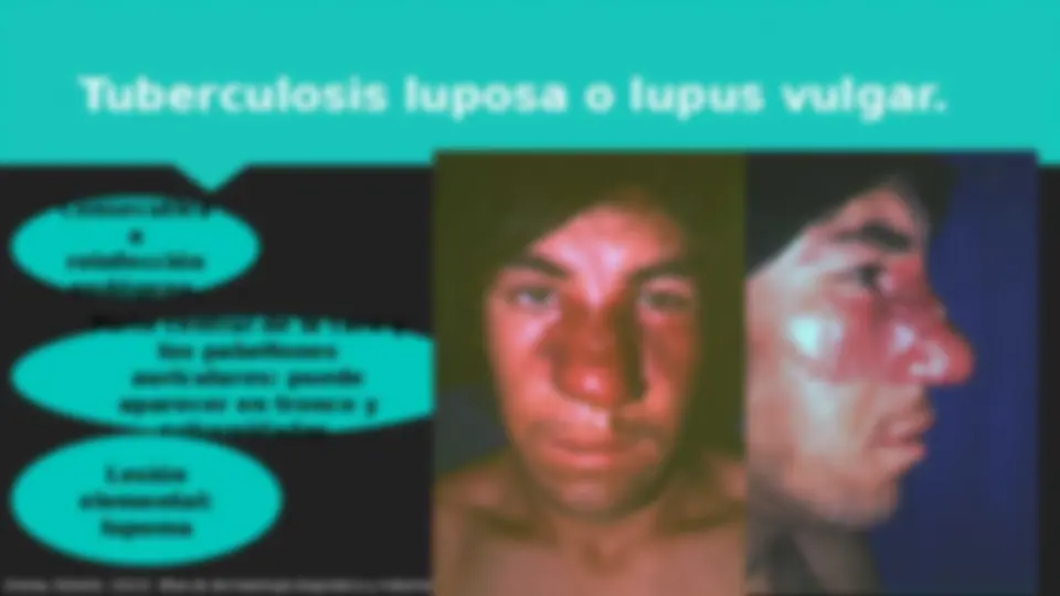 pf14