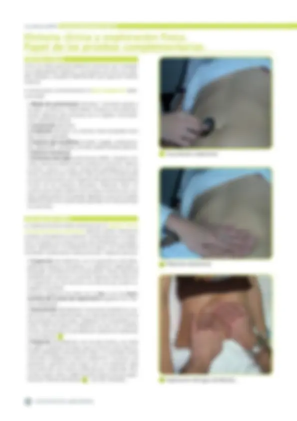 pf24