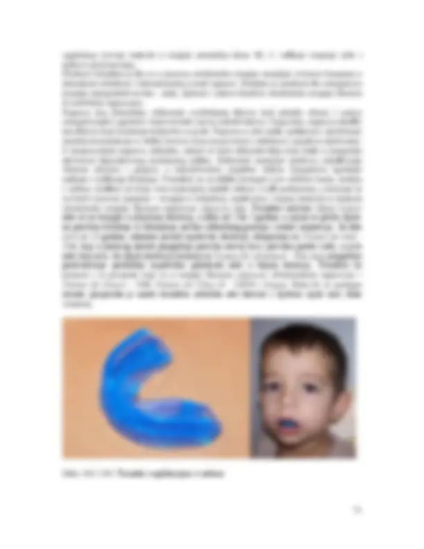 pf4d