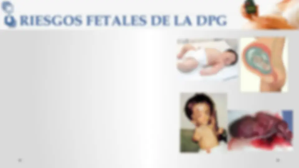 pfd