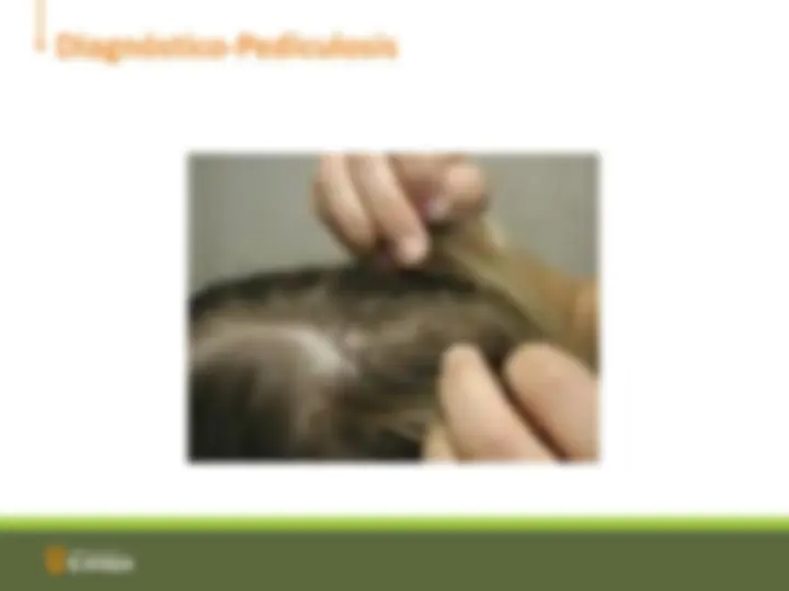 pf16