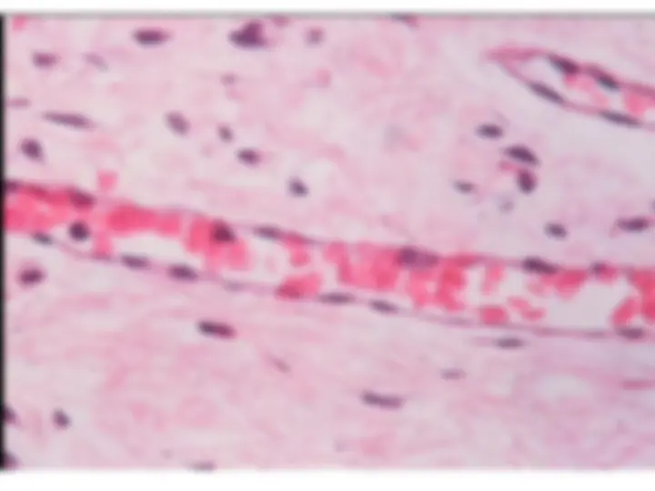 pf5