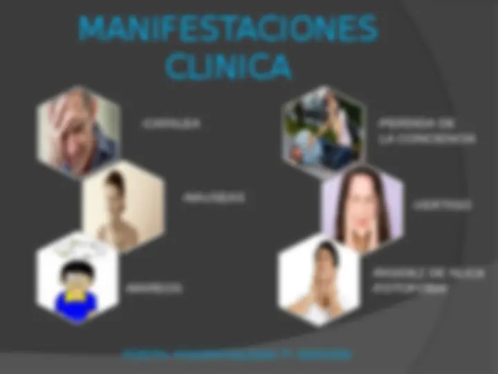 pfe