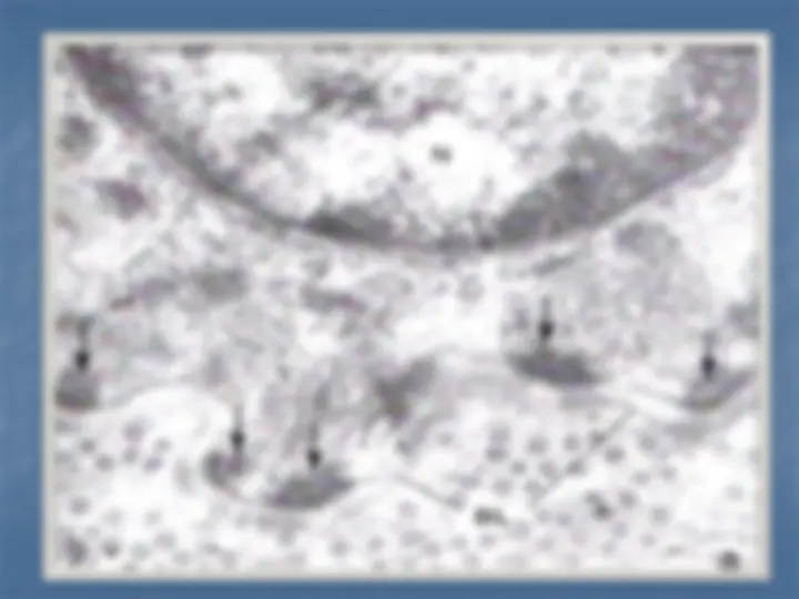 pf2f