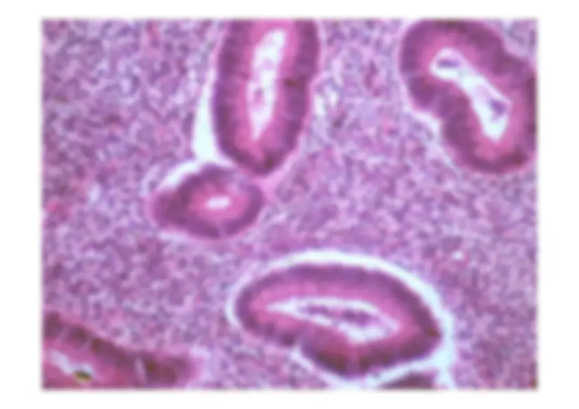 pf54