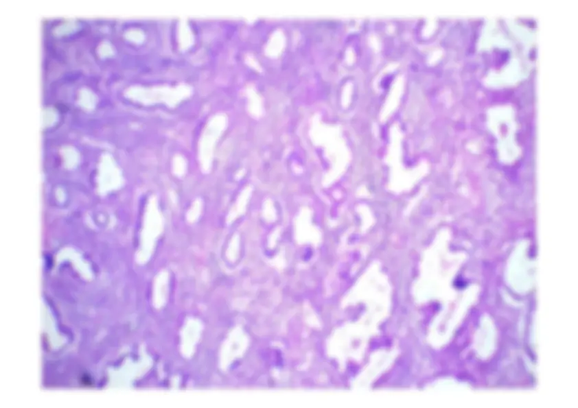 pf57