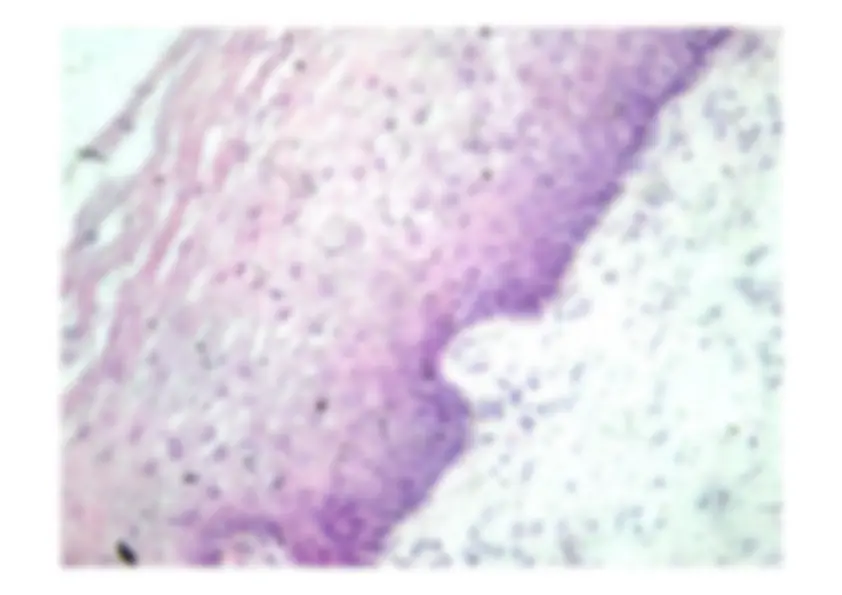 pf5f