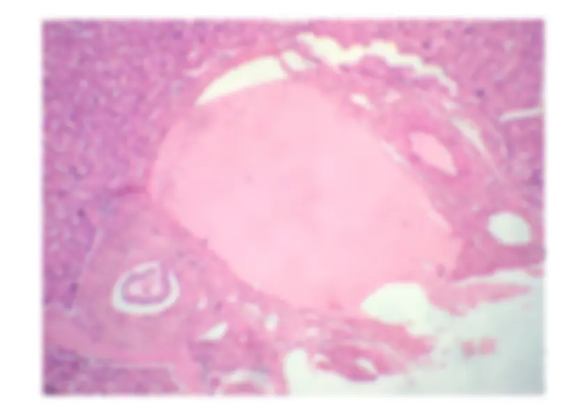 pf1a