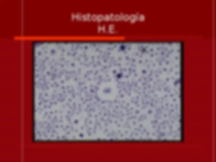 pf39