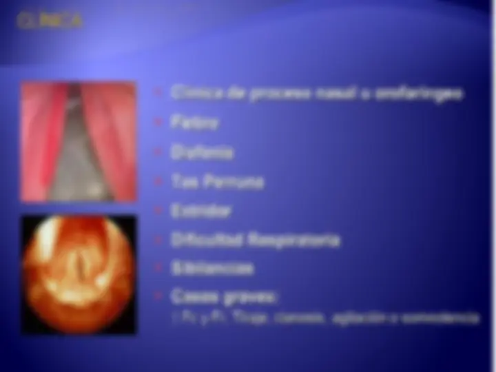 pf17