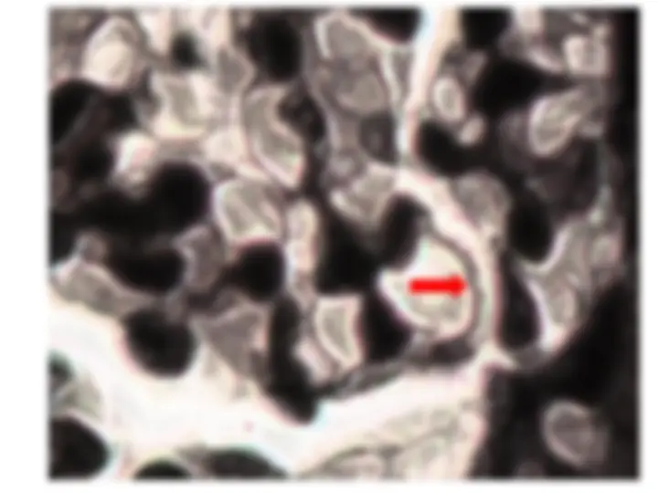 pf31