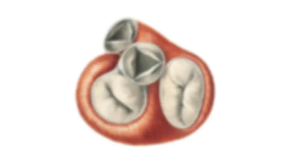 pfa