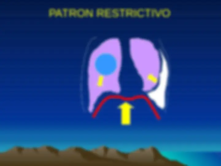 pfd