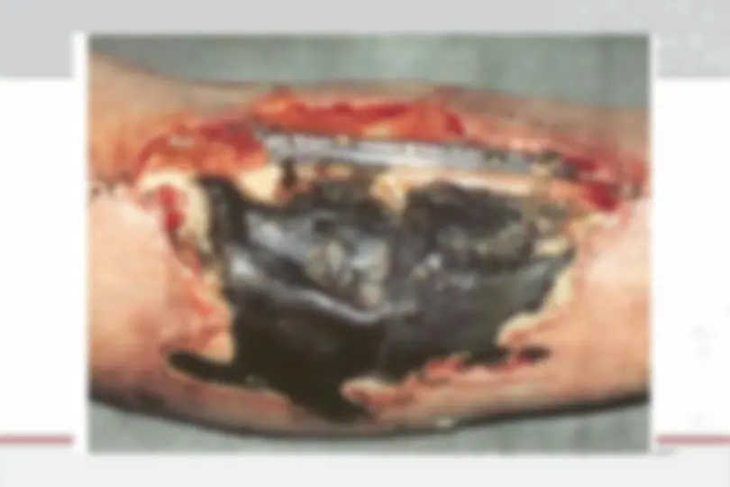 pf33