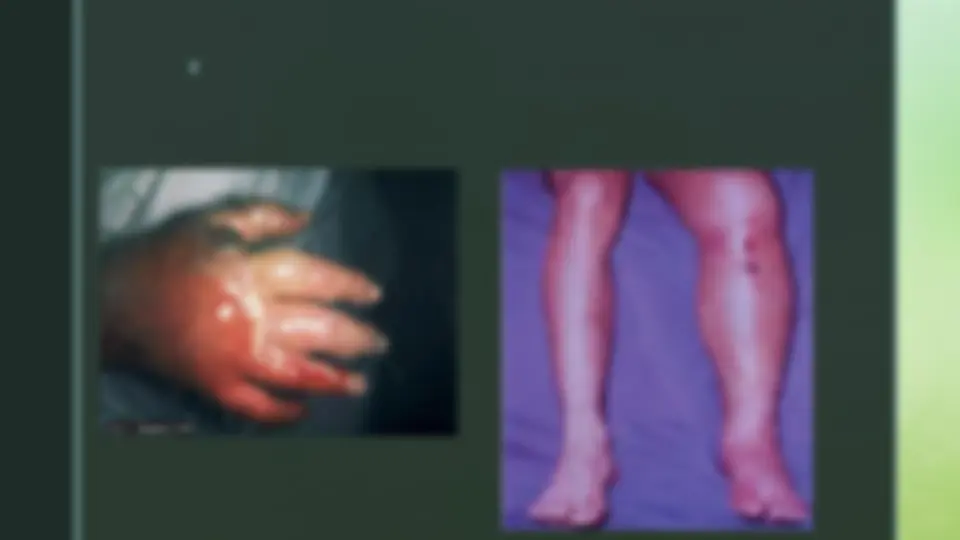 pff
