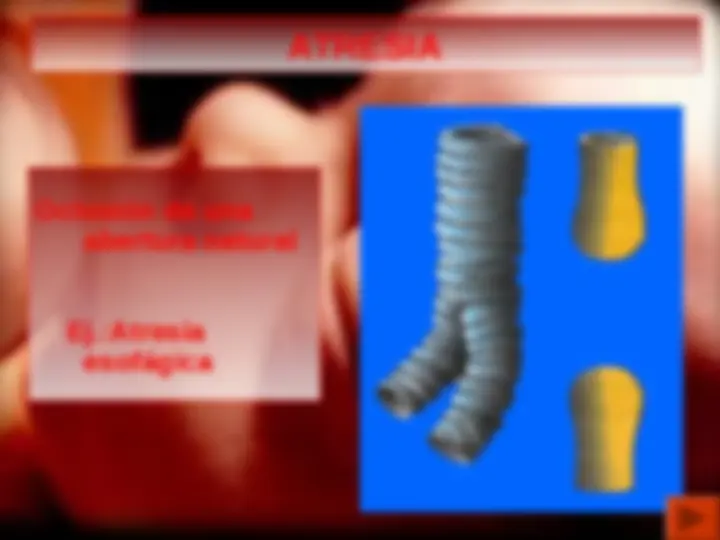 pf1d