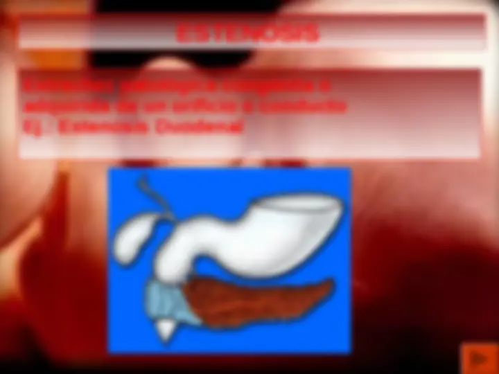 pf1e