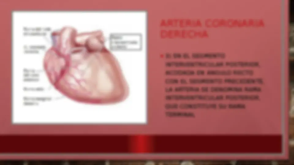 pf1a