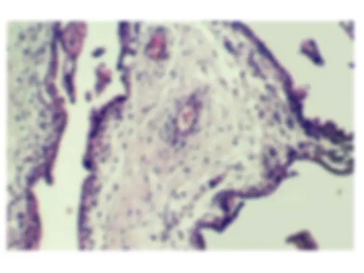 pf5
