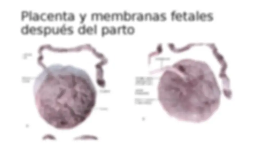 pf14
