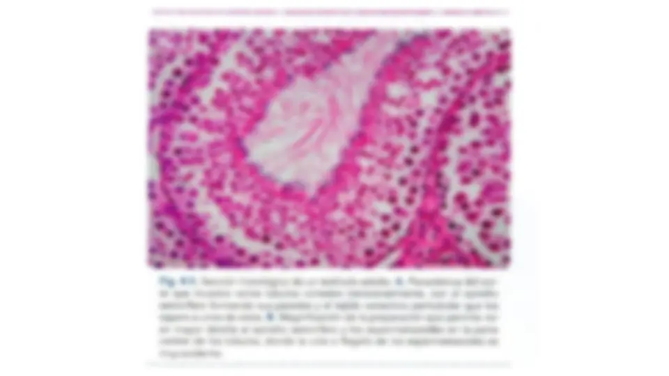 pf34