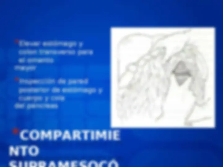 pf14