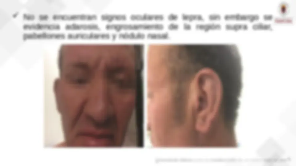 pff