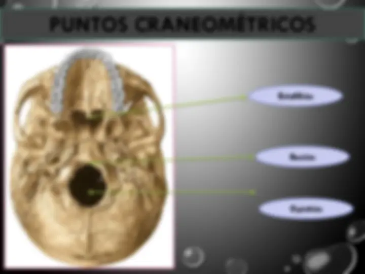 pfa