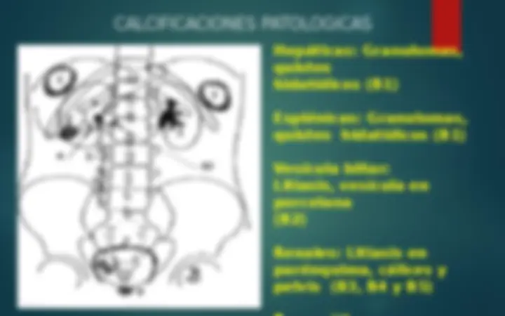 pf12