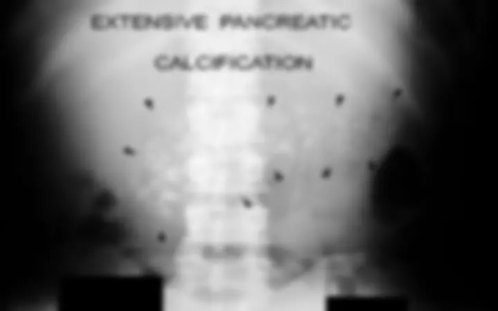 pf14
