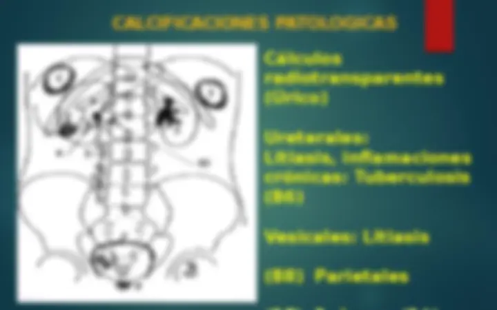 pf13